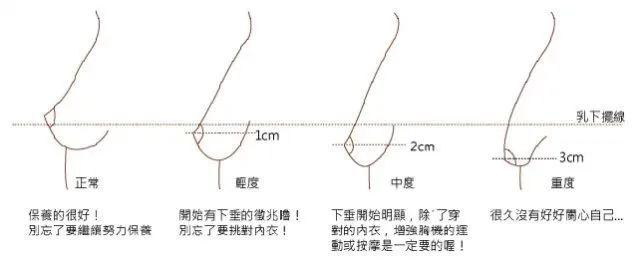 胸下垂,大臂赘肉?5个动作徒手升杯,你快练练!