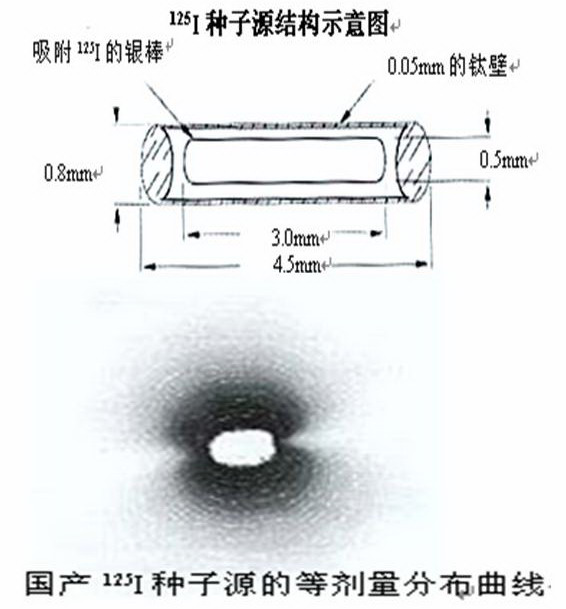 碘125粒子植入技术治疗癌症有哪些优点呢