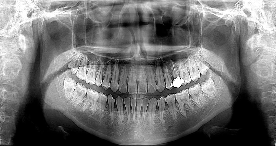 ����һ��ҽ����Ƽ��������ں�