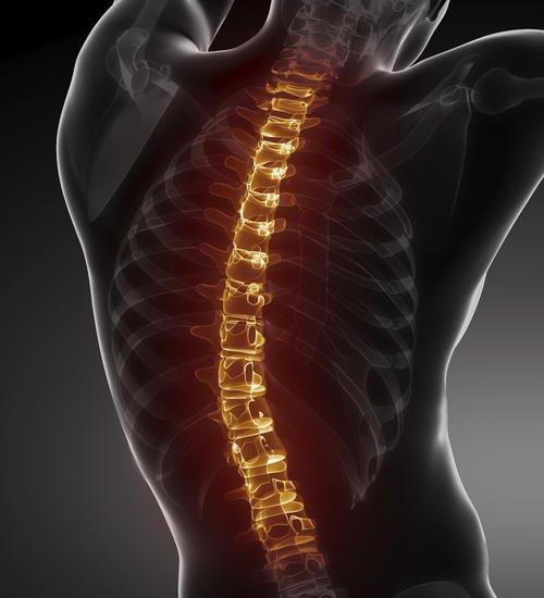 强直性脊柱炎的早期症状是什么,是怎么引起的呢?