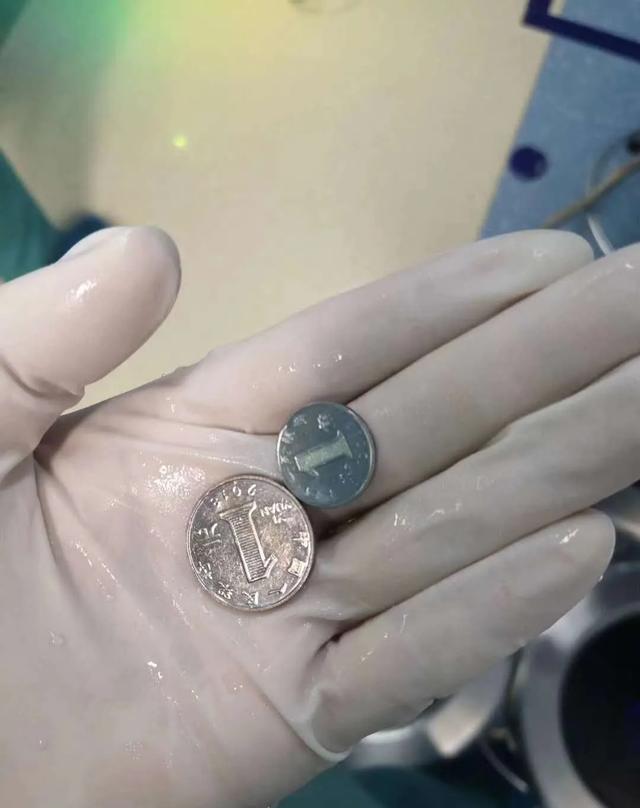 「东东」太危险 秦皇岛4岁男孩吞两枚硬币被卡住！