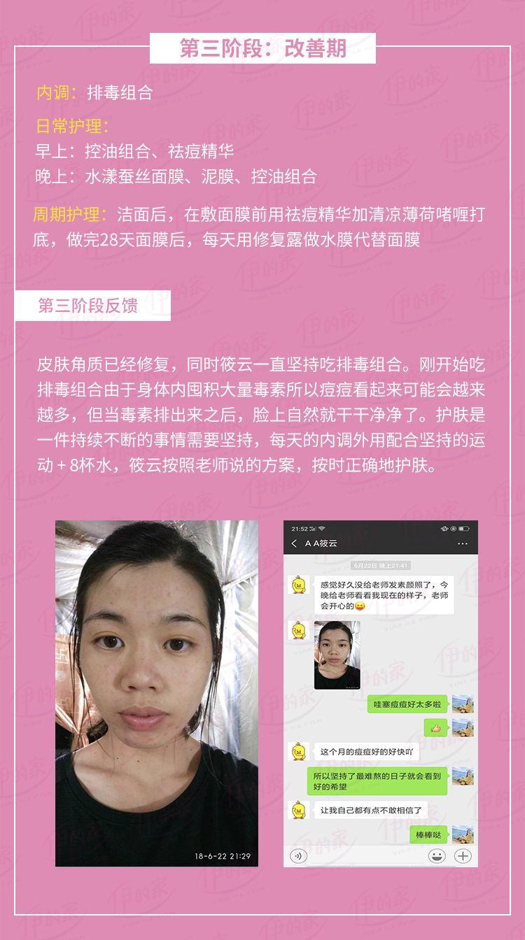 伊的家老a老师vip真实改善案例痘痘大作战