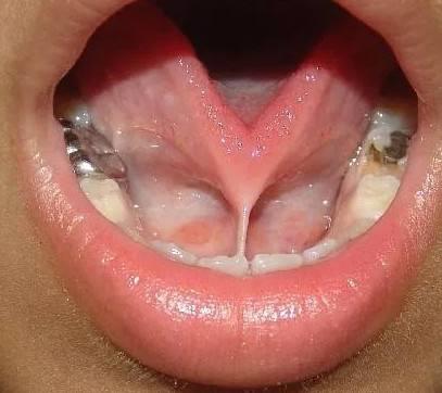 被人嘲笑大舌头只能剪舌系带吗说话不清楚真的是舌头的问题吗