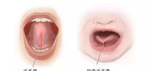 怎么看小孩舌筋短不短 83f8c2f0d7574c4687c02cbda856dd01.jpeg