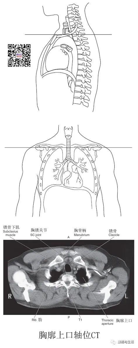 正常肺ctmr