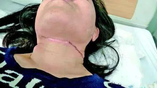 「风筝」惨痛！孩子放风筝,夫妻一个动作导致双双截掉四肢......