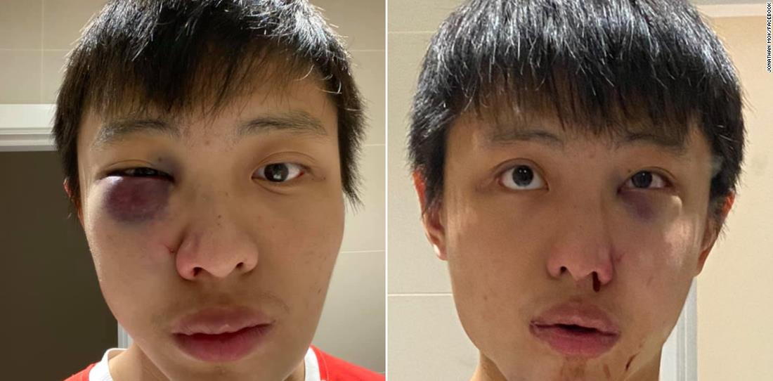 病毒人口述_病毒简笔画
