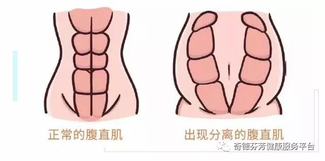 腹甲什么成语_成语故事图片(2)