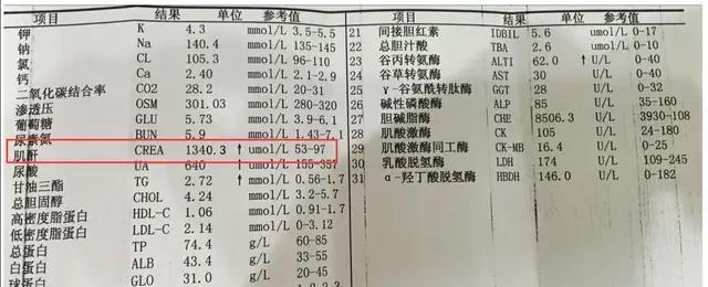 肌酐109严重吗 来自搜狐网