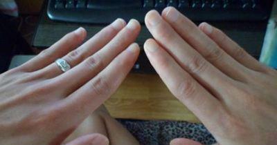 两根手指指甲掉了猜成语_看图猜成语(2)