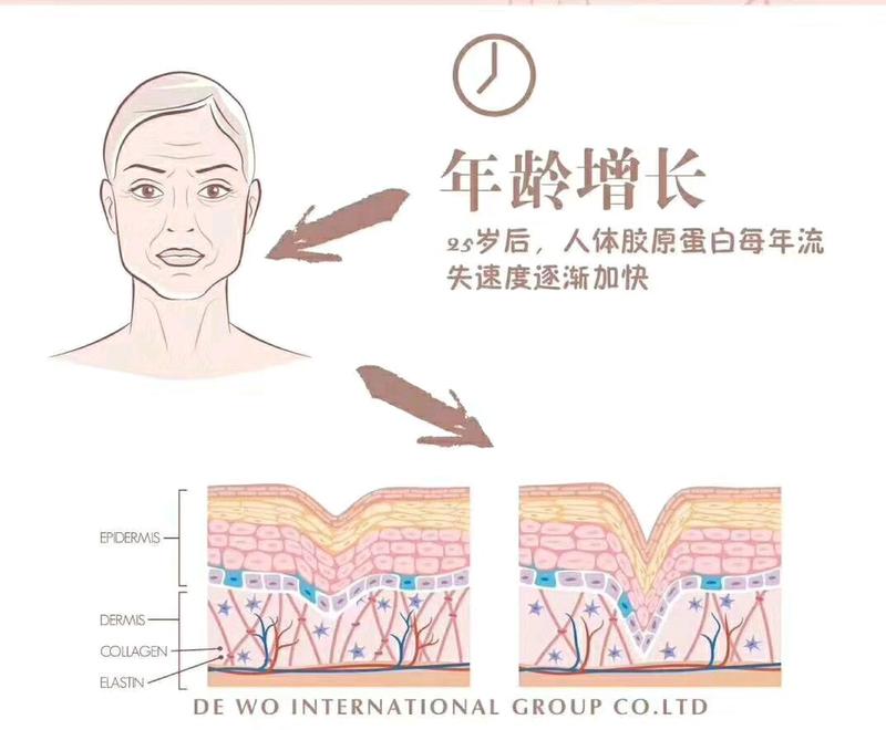 肌肤干燥,也是因为胶原蛋白的流失.