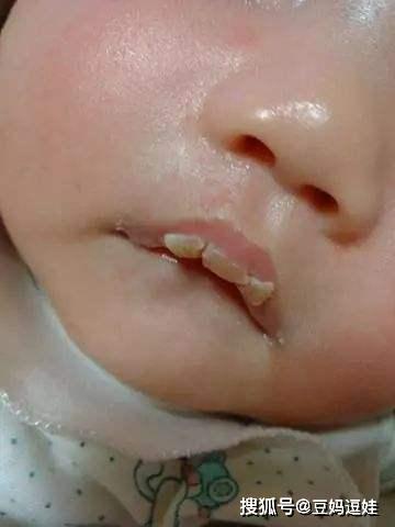 婴儿几个月能吃盐和油 f213df9ce2f848a7adc8d8ee4dc32960.jpeg