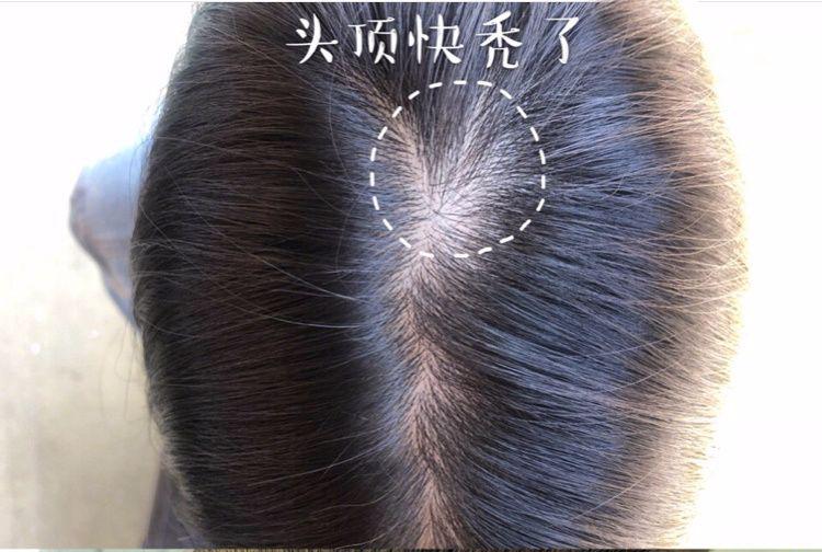 “灭顶之灾”成痛楚!娱乐圈的“男神”“女神”们也没能逃过这一劫,原因竟是…… “灭顶之灾”成痛楚!娱乐圈的“男神”“女神”们也没能逃过这一劫,原因竟是……