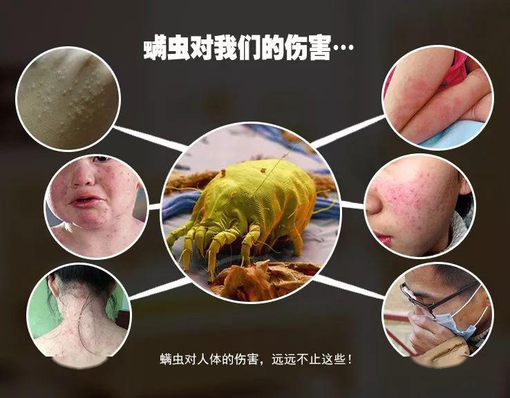 "每晚600万螨虫陪你睡"竟然是真的!床上赶紧放个它,比