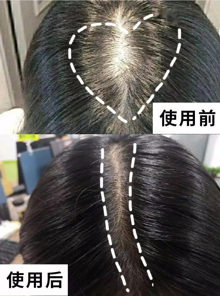 “灭顶之灾”成痛楚!娱乐圈的“男神”“女神”们也没能逃过这一劫,原因竟是…… “灭顶之灾”成痛楚!娱乐圈的“男神”“女神”们也没能逃过这一劫,原因竟是……