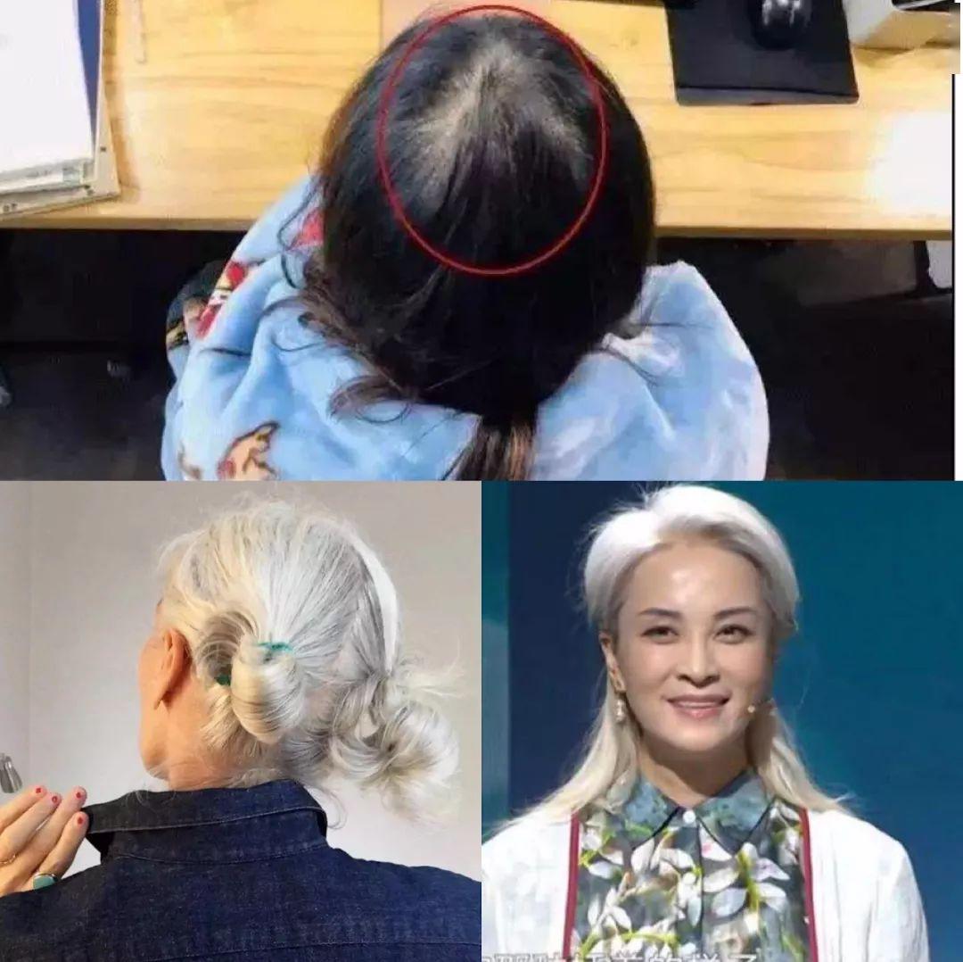 “灭顶之灾”成痛楚!娱乐圈的“男神”“女神”们也没能逃过这一劫,原因竟是…… “灭顶之灾”成痛楚!娱乐圈的“男神”“女神”们也没能逃过这一劫,原因竟是……