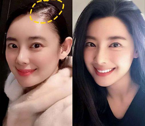 “灭顶之灾”成痛楚!娱乐圈的“男神”“女神”们也没能逃过这一劫,原因竟是…… “灭顶之灾”成痛楚!娱乐圈的“男神”“女神”们也没能逃过这一劫,原因竟是……