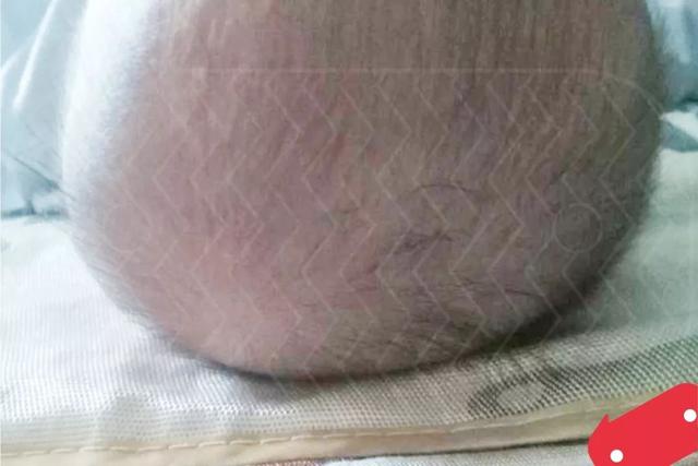 宝宝■让宝宝睡出完美头型！宝宝头睡偏了还能“圆”回来吗？这几招