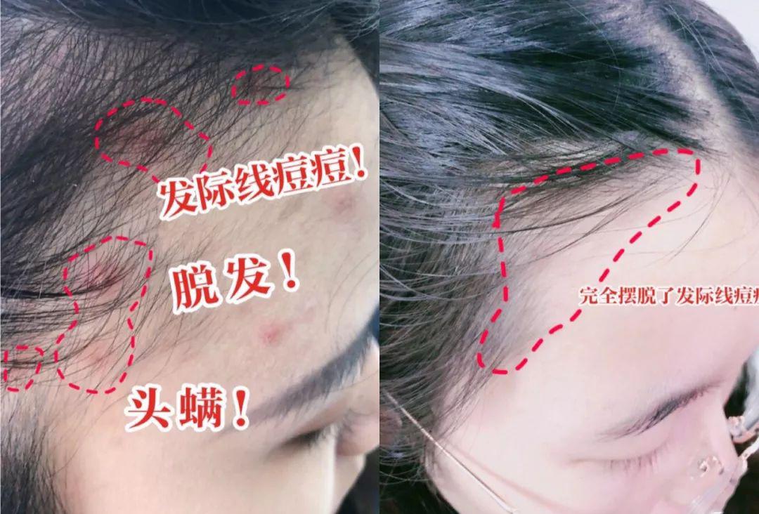 “灭顶之灾”成痛楚!娱乐圈的“男神”“女神”们也没能逃过这一劫,原因竟是…… “灭顶之灾”成痛楚!娱乐圈的“男神”“女神”们也没能逃过这一劫,原因竟是……