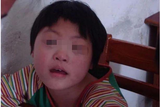 【孩子】医院检查血压高达180，凶手居然是父亲6岁女儿一直喊头疼