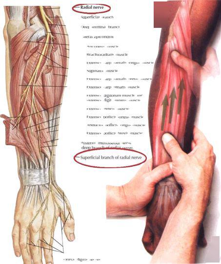 一个典型指征是—前臂伸肌瘫痪,表现为抬前臂时呈"垂腕"状态.