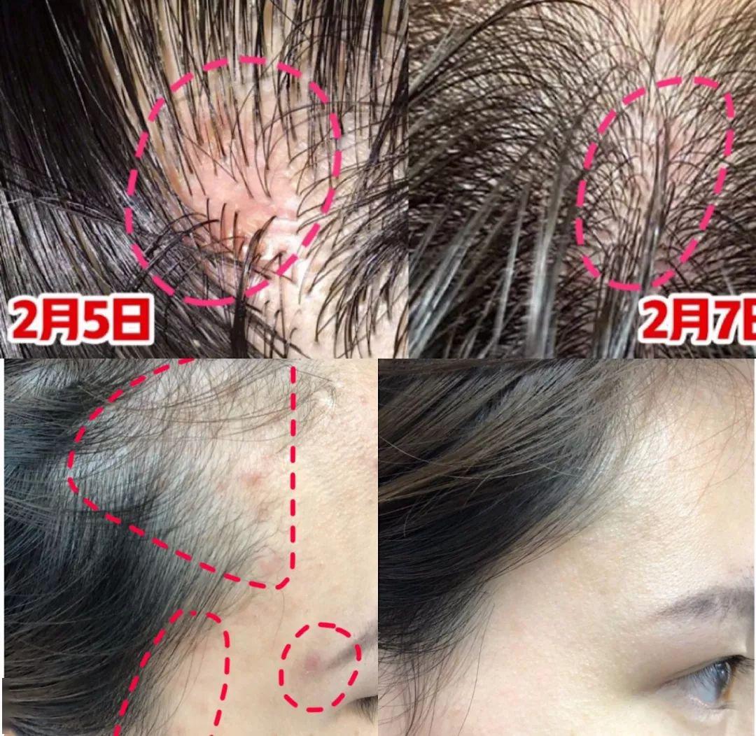 “灭顶之灾”成痛楚!娱乐圈的“男神”“女神”们也没能逃过这一劫,原因竟是…… “灭顶之灾”成痛楚!娱乐圈的“男神”“女神”们也没能逃过这一劫,原因竟是……