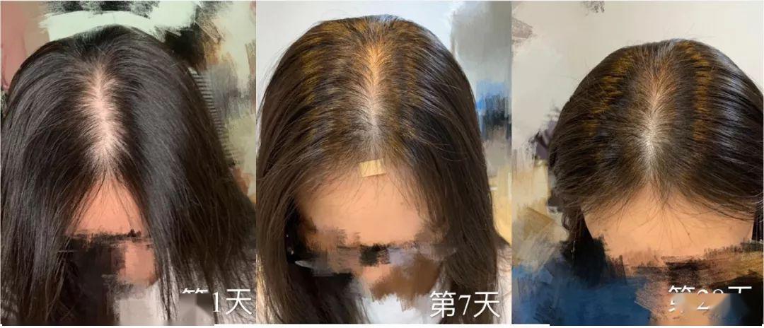 “灭顶之灾”成痛楚!娱乐圈的“男神”“女神”们也没能逃过这一劫,原因竟是…… “灭顶之灾”成痛楚!娱乐圈的“男神”“女神”们也没能逃过这一劫,原因竟是……