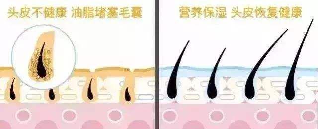 “灭顶之灾”成痛楚!娱乐圈的“男神”“女神”们也没能逃过这一劫,原因竟是…… “灭顶之灾”成痛楚!娱乐圈的“男神”“女神”们也没能逃过这一劫,原因竟是……