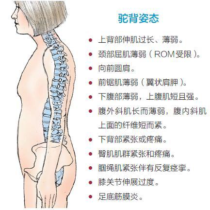 如何练好背体态矫正方法 d8352c4524534b9c9ef9010c58ded090.jpeg