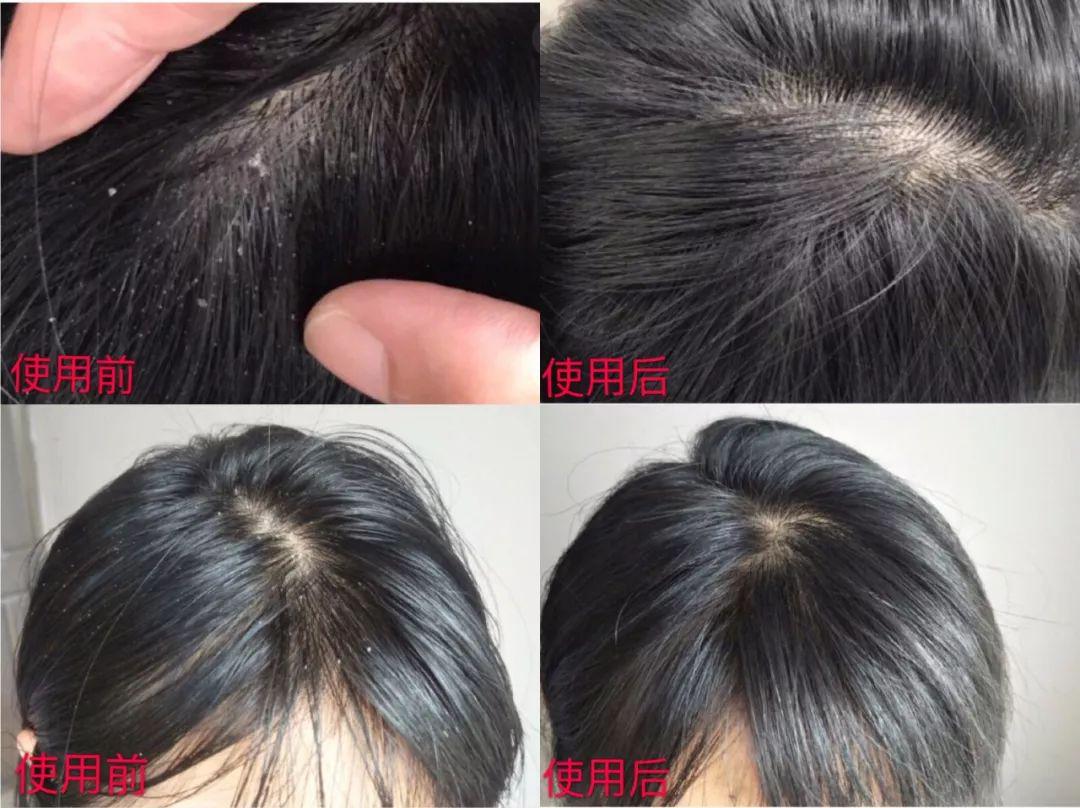 “灭顶之灾”成痛楚!娱乐圈的“男神”“女神”们也没能逃过这一劫,原因竟是…… “灭顶之灾”成痛楚!娱乐圈的“男神”“女神”们也没能逃过这一劫,原因竟是……