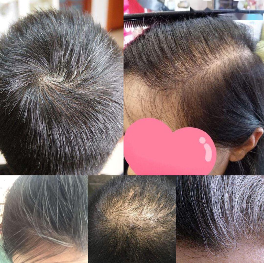 “灭顶之灾”成痛楚!娱乐圈的“男神”“女神”们也没能逃过这一劫,原因竟是…… “灭顶之灾”成痛楚!娱乐圈的“男神”“女神”们也没能逃过这一劫,原因竟是……