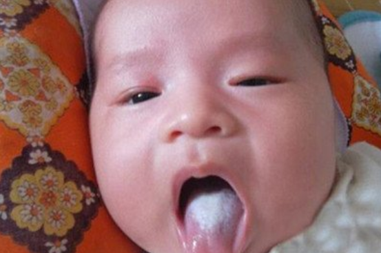 #孩子#说明严重积食了,一查一个准,家长别大意孩子身体出现6个异常