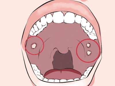 9830af8486db4f2b9f20294438fe7f0b.png
