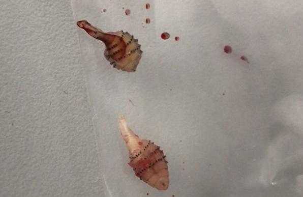 标签:长虫疮是什么原因引起的