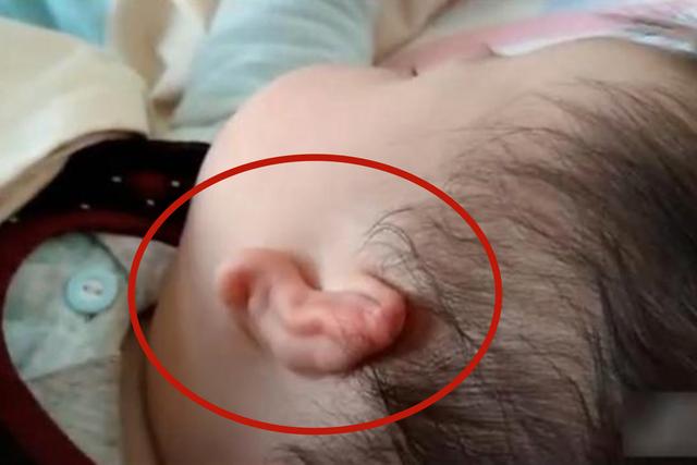 孩子■宝妈发圈叹神奇见过这样的智能耳朵吗？听见爸爸打呼噜自动关闭