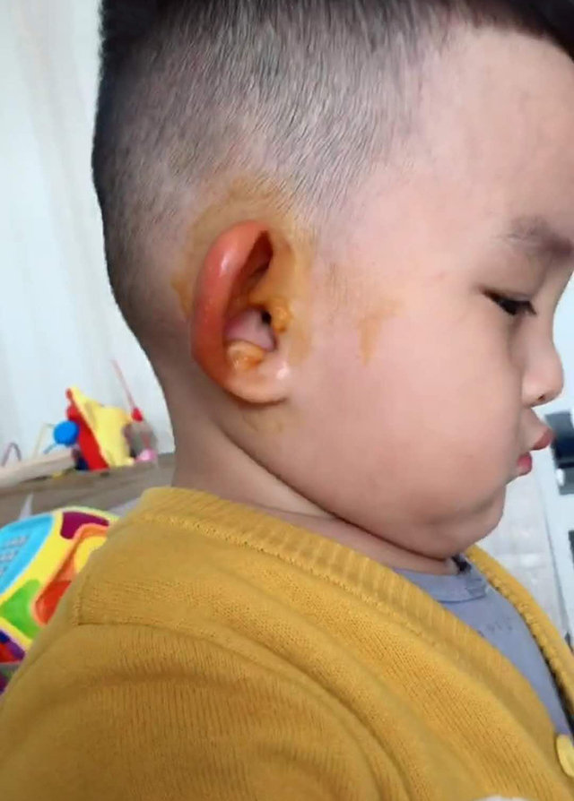「蚊虫」蚊子“吻了”儿子两只耳朵，结果一觉醒来，哈哈哈趁老母亲不备