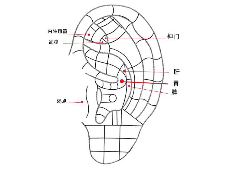 2,耳穴方面:胃,脾,肝,神门,渴点,盆腔,内生殖器.