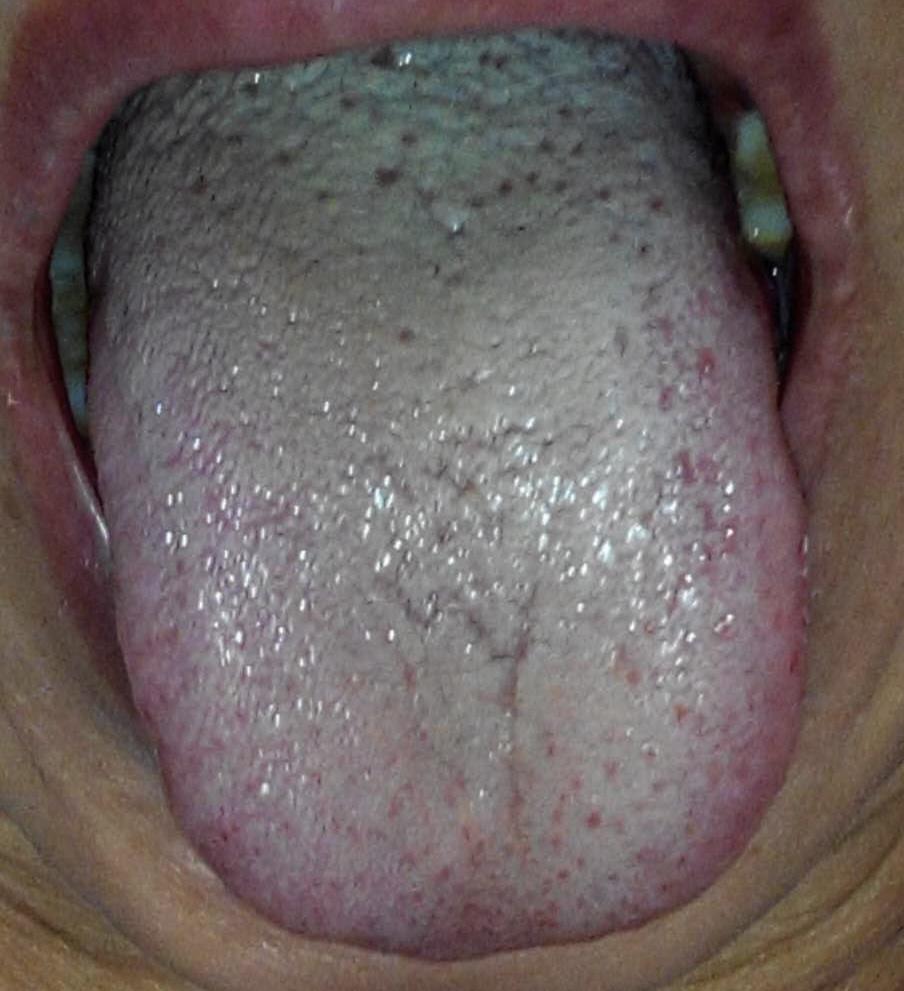 85cdd82385ed4dae90744cb6ad20a120.jpeg
