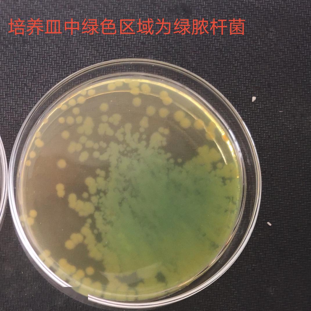 2ml水中所含的大肠杆菌数量 (严重超标)其中粉红色菌落为大肠杆菌)