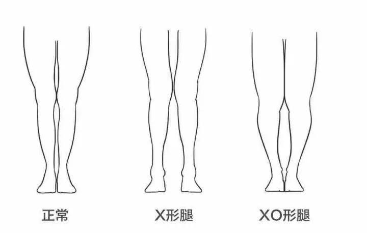 没了修图师,林允儿腿型辣眼,吴昕粗腿暴露,她更是山路