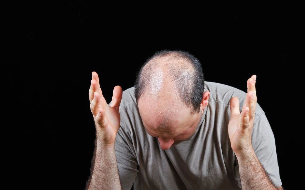 就会出现掉头发，秃顶的表现，如果你的头发越掉越多，这时就要注意了。