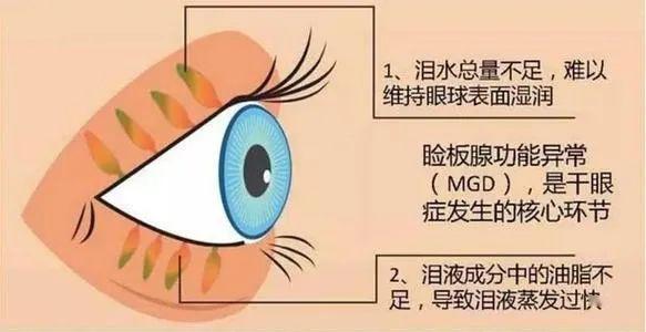 8cff79e93e5e4febb4af767dd11800cf.jpeg