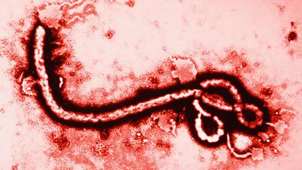 因此,有人形容染上埃博拉的人是在你面前慢慢融化掉.