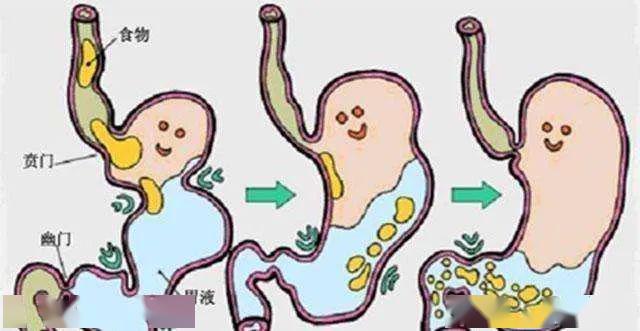 怎么才能让自己得胃病 b43a2df15613445694fee8fa01b5b06f.jpeg