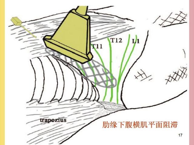 北京铜屏风价格 上海普孜铜制品供应