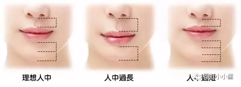 原创详解:人中沟是如何增加或者拖累颜值的|日本医美