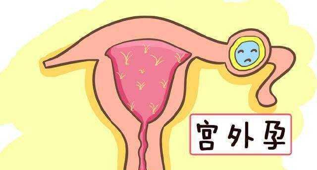 什么时候能测出来是宫内孕 05c1e4a3819a45aba071c3ec91126a3d.jpeg