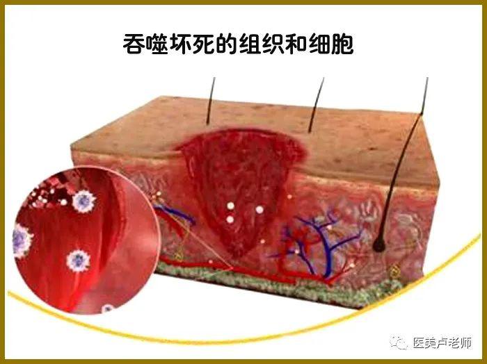 术后伤口愈合的形态基础