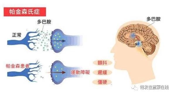 什么是电解质紊乱的症状 62953b1083d2462ea03f0964c1049b87.jpeg