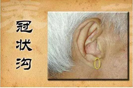 897ce8cb956941abb464e12584c82ce3.JPG